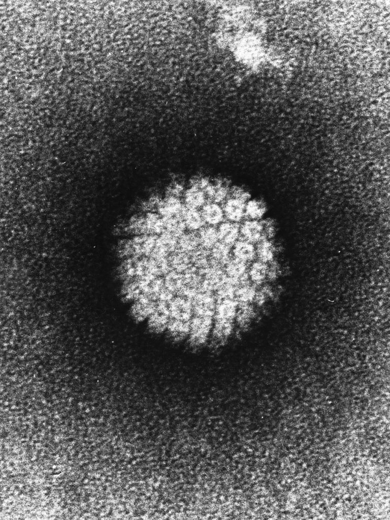 The HPV Virus